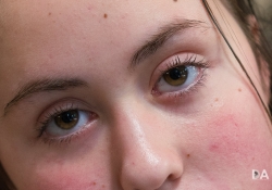 15 Eye AF-2 15 Eye AF-2